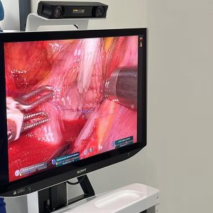 Sistema Robótico de Cirugías